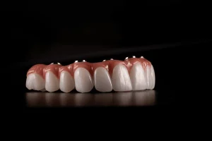implantes dentales all on 6