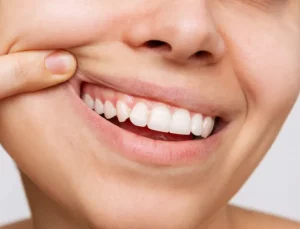 Periodoncia