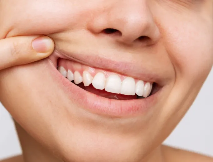 Periodoncia